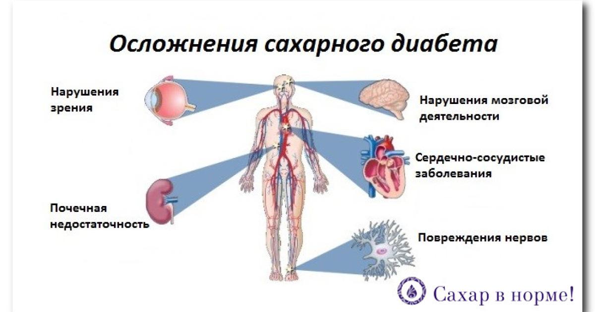 Диагностика и лечение сахарного диабета (Александров) | Парацельс